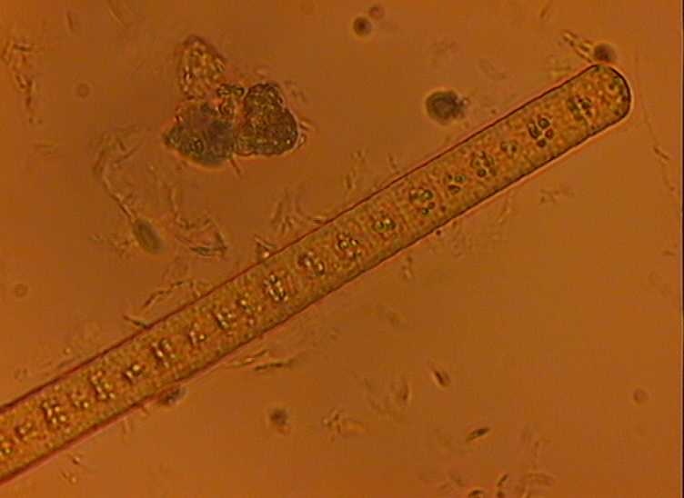 Dictyocha speculum